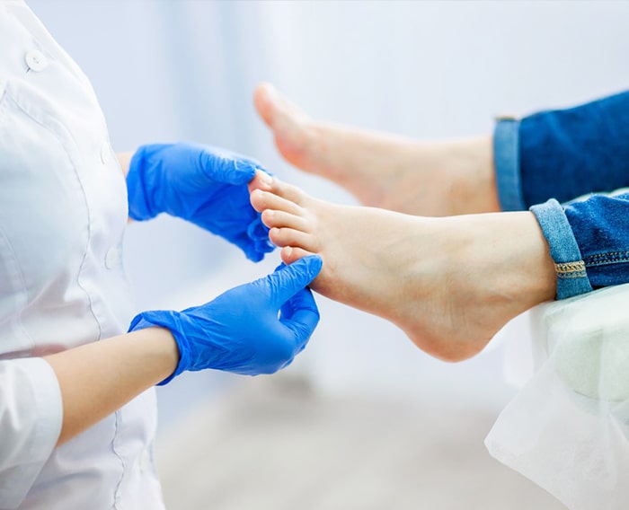 Podologie - Transpirație în exces